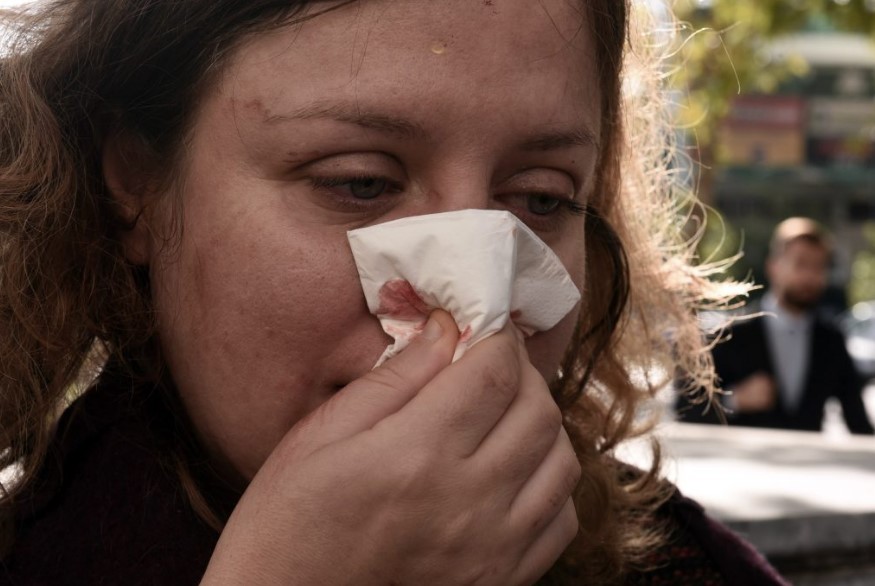 Άνανδρη επίθεση 30 χρυσαυγιτών σε 2 γυναίκες - Τραυμάτισαν δικηγόρο της Πολ. Αγωγής στη δίκη της Χρυσής Αυγής (φωτογραφίες)