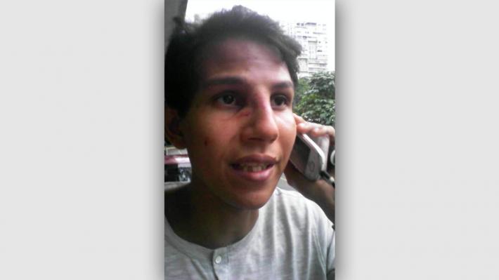 Κάτω τα χέρια από την ΚN Βενεζουέλας - Τραμπούκικη επίθεση με τραυματίες στο Πανεπιστήμιο Μπολιβάρ του Καράκας